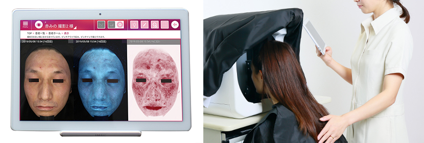 Skin Analysis