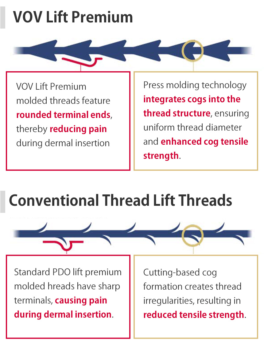 Differences Between VOV Lift Premium Threads and Conventional Thread Lifts