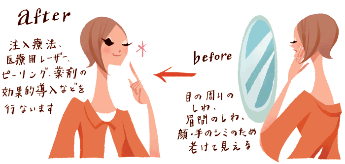 【before】目の周りのしわ、顔・手のシミのため老けて見える→【after】注入療法、医療用レーザー、ピーリング、薬剤の効果的導入などを行います。